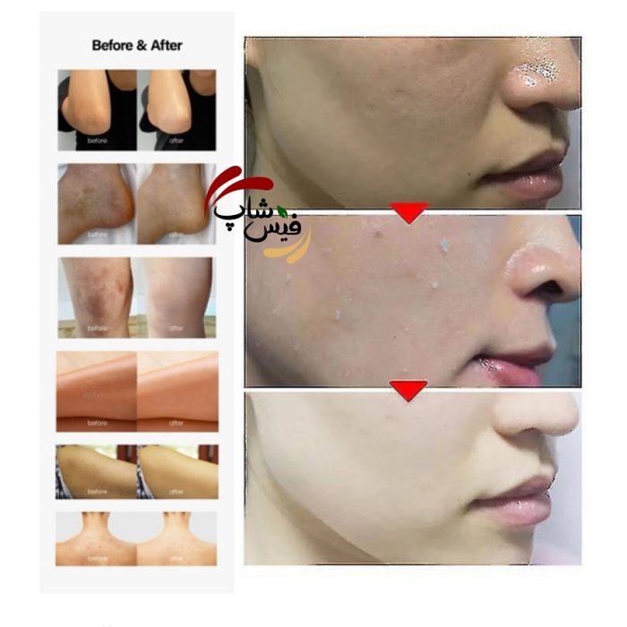 ژل پیلینگ روشن کننده دکتر جی ( Dr.G ) - Image 3