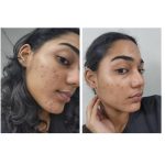 کرم ضدلک و روشن کننده و ترمیم کننده دکتر التیا Dr. Althea - Image 5
