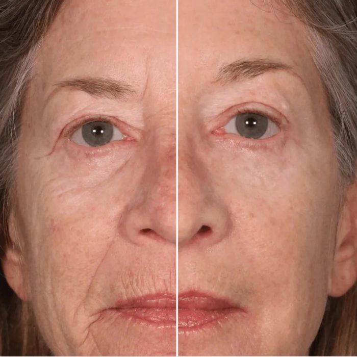 سرم کوکسیر پپتید EGF فشرده و کلاژن با اثر لیفتینگ 50 میل COXIR INTENSIVE EGF PEPTIDE SERUM - Image 3