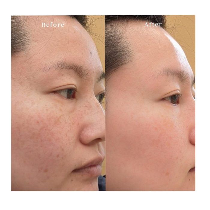 کرم کوکسیر پپتید فشرده ابرسان وضد پیری قوی کلاژن ساز 50 میل COXIR Intensive EGF Peptide Cream - Image 5