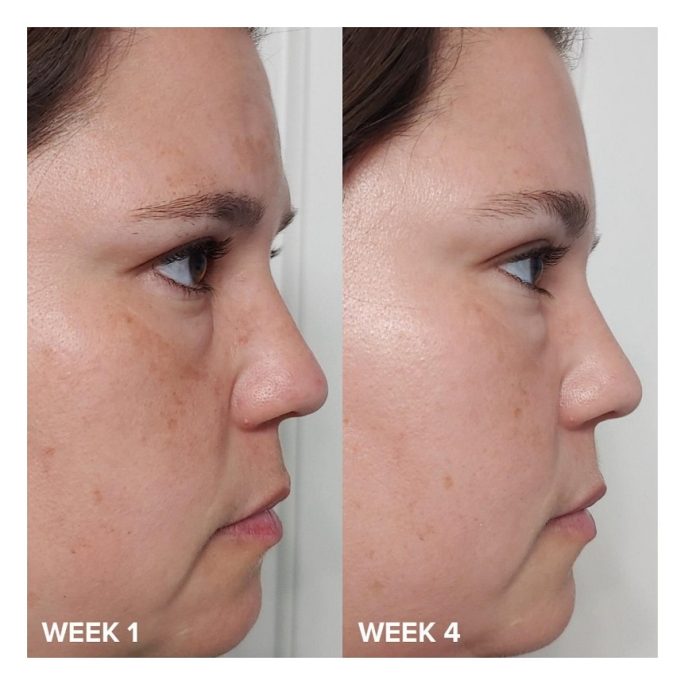 تونر پوست چرب و جوشدار پائولا چویس PAULA'S LE CHOICE XFOL IAT SKIN PERFECTING 2% BHA Liquid Exfoliant SALICYLIC ACID All Skin Types UNCLOGS & SHRINKS ENLARGED PORES SMOOTHS &EVENS SKIN TONE LIGHTWEIGHT LIQUID ABSORBS QUICKLY 118 ml - Image 5