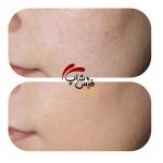 سرم روشن کننده و ضد لک قوی پریویا - Image 3