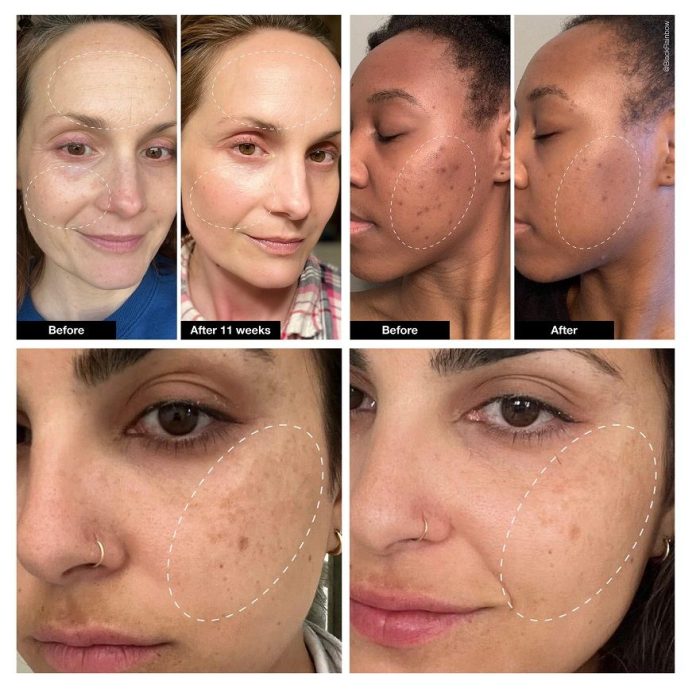 سرم رتینول ضد چروک Skin Renewing سراوی 30 میل - Image 3