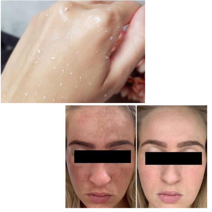 پیلیینگ لایه بردار برنج تری دبلیو کلینیک 3W CLINIC - Image 3