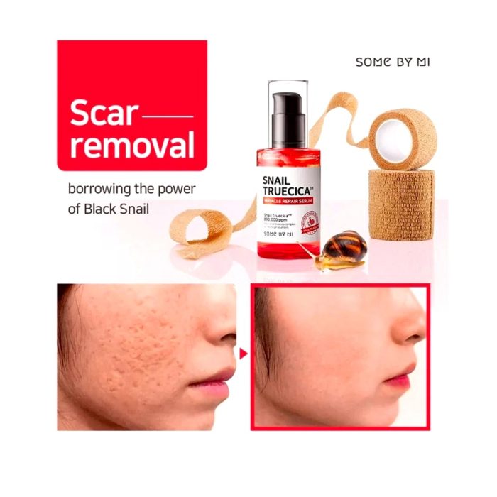 سرم ترمیم کننده حلزون سام بای می Some By Me Snail Truecica Serum - Image 2