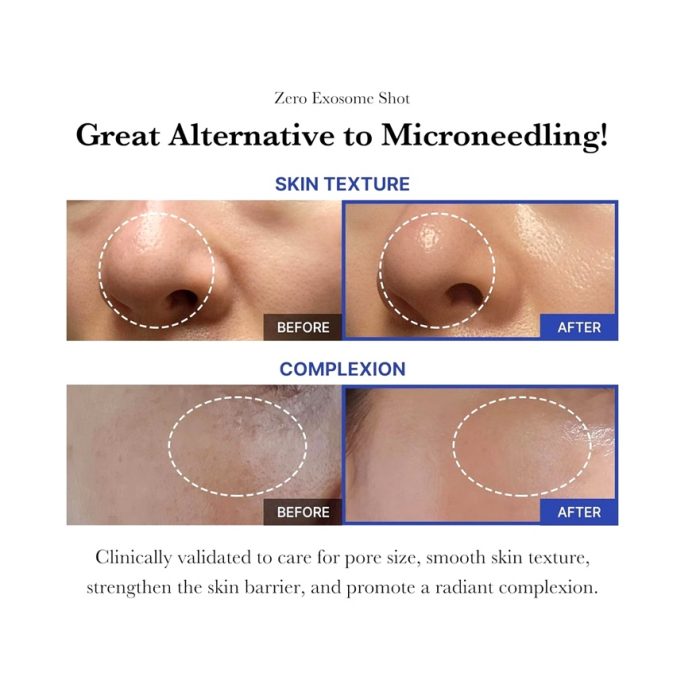 سرم کوچک کننده منافذ مدی کیوب لایه بردار Medicube - Image 8