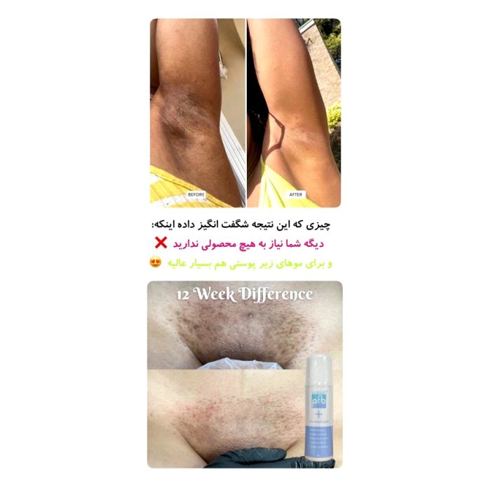 رول ژلی روشن کننده بدن ضدلک و درمان تیرگی پی اف بی وانیش pfb - Image 2