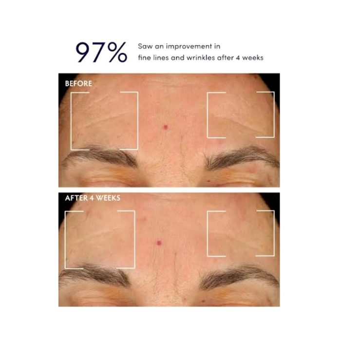 سرم ضد چروک و حجم دهنده باکوچیول اکوال بری Eqqualberry Bakuchiol Plumping Serum - Image 6