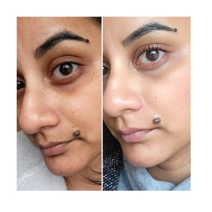 سرم ضد چروک و حجم دهنده باکوچیول اکوال بری Eqqualberry Bakuchiol Plumping Serum - Image 7