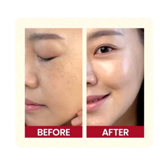 کرم کپسولی ترانگزامیک اسید و نیاسینامید مدی کیوب Medicube TXA Niacinamide Capsule Cream - Image 2