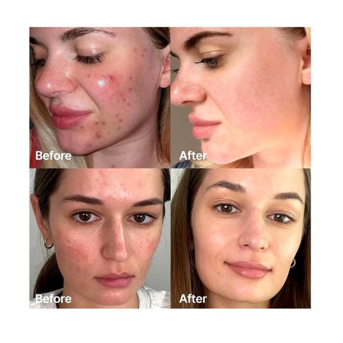 کرم کپسولی ترانگزامیک اسید و نیاسینامید مدی کیوب Medicube TXA Niacinamide Capsule Cream - Image 4