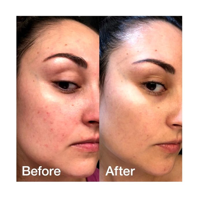 کرم کپسولی ترانگزامیک اسید و نیاسینامید مدی کیوب Medicube TXA Niacinamide Capsule Cream - Image 5