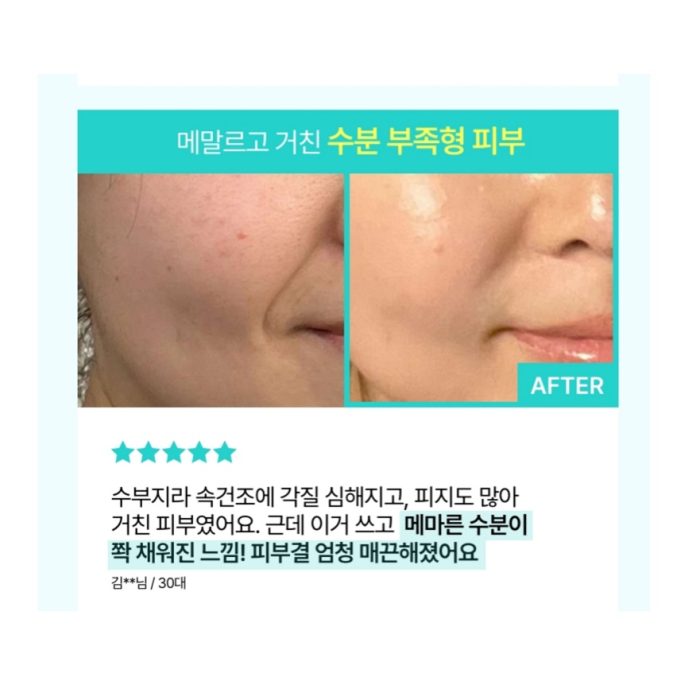 کرم مرطوب کننده و آبرسان PDRN و هیالورونیک اسید آنوا Anua PDRN Hyaluronic Acid 100 Moisturizing Cream - Image 3