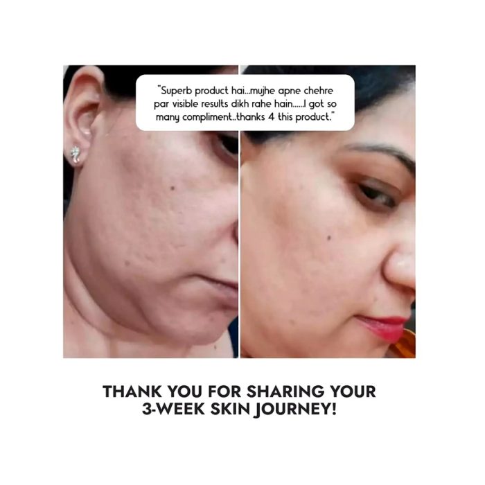 سرم آبرسان و جوانساز مدیکیوب Multi Peptide حجم 30میل - Image 6