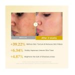 تونر کوجیک اسید و زردچوبه مدی کیوب | روشن کننده ولایه بردار (250 میل) - Image 5
