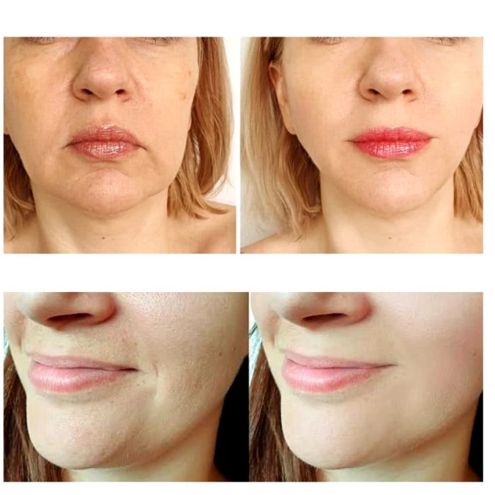 کرم جوانساز پوست طلا و کلاژن 3W Clinic collagen luxury gold - Image 3