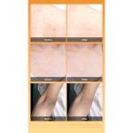 اسپری لایه بردار بدن کوجیک اسید و زردچوبه دکتر ملاکسین - Image 3