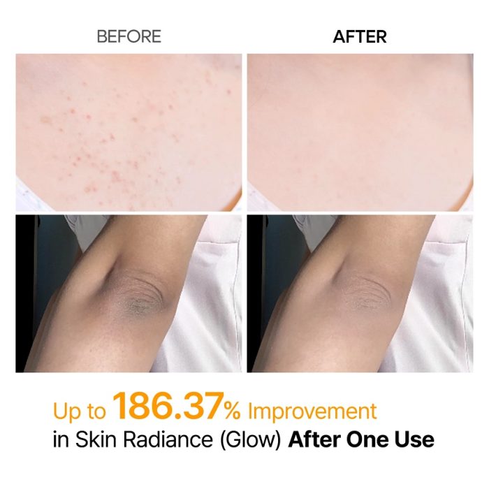 پیل شات بدن کوجیک اسید و زردچوبه مدی‌ کیوب Medicube Kojic Acid Body Peel Turmeric Shot - Image 4