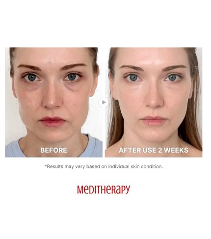 InShot_20251115_035856339